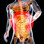 cancer du pancreas