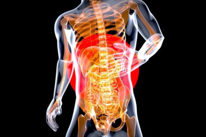 cancer du pancreas